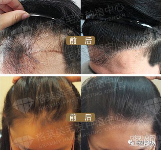 https://img.miyanlife.com/mnt/timg/180722/1249231V5-3.jpg