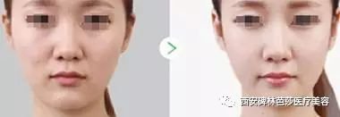 https://img.miyanlife.com/mnt/timg/180722/124945L21-5.jpg