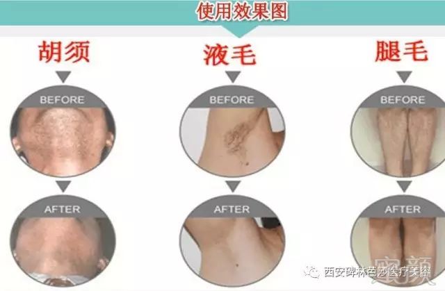 https://img.miyanlife.com/mnt/timg/180722/12494620M-11.jpg