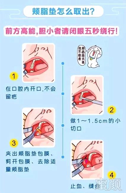 https://img.miyanlife.com/mnt/timg/180722/124T04L6-1.jpg