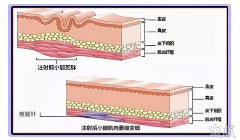 https://img.miyanlife.com/mnt/timg/180722/1255312c8-5.jpg