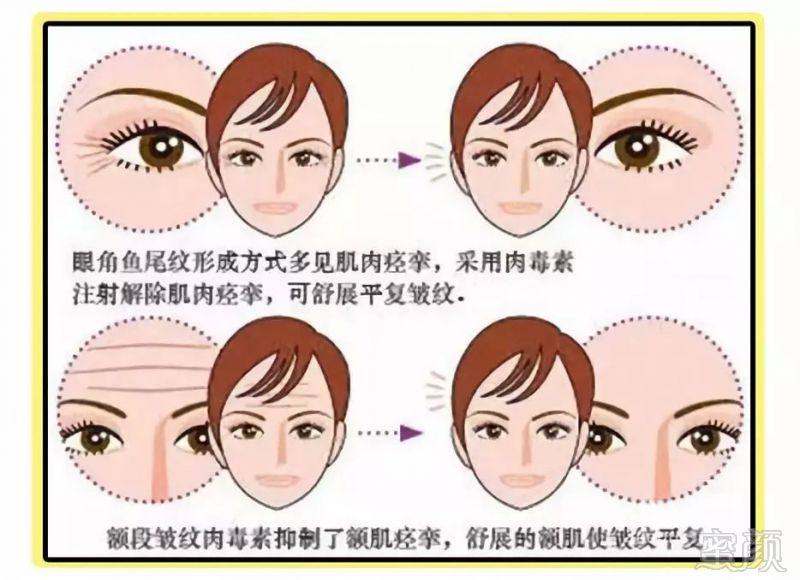 https://img.miyanlife.com/mnt/timg/180722/1255313541-7.jpg