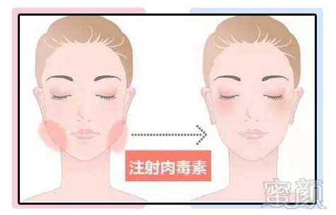 https://img.miyanlife.com/mnt/timg/180722/1255353I1-15.jpg