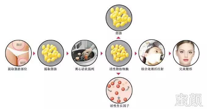 https://img.miyanlife.com/mnt/timg/180722/125H52a6-1.jpg