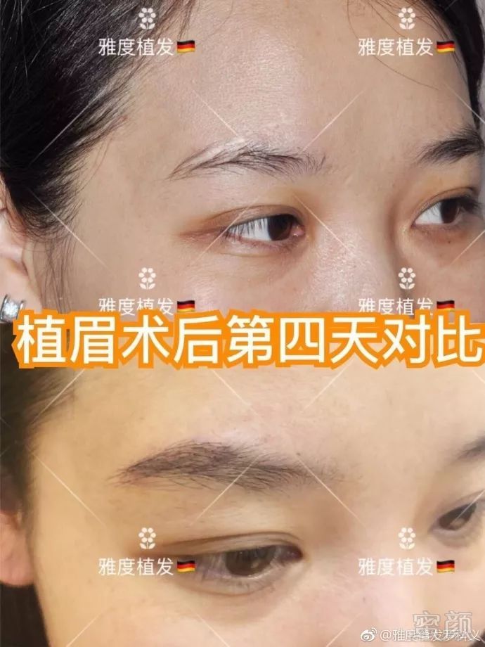 https://img.miyanlife.com/mnt/timg/180722/13014BL3-10.jpg
