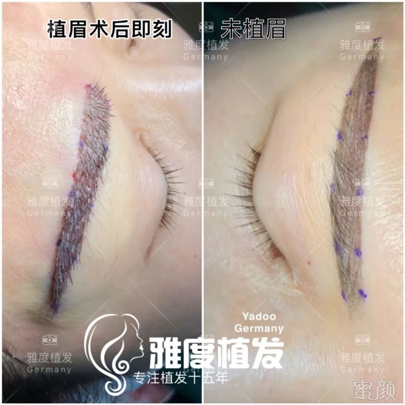 https://img.miyanlife.com/mnt/timg/180722/13014J163-11.jpg