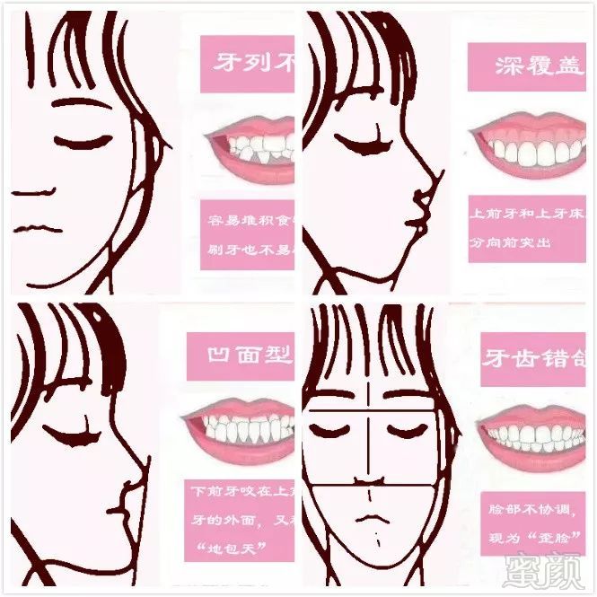 https://img.miyanlife.com/mnt/timg/180722/13014J1A-2.jpg