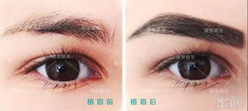 https://img.miyanlife.com/mnt/timg/180722/13014T1Y-13.jpg