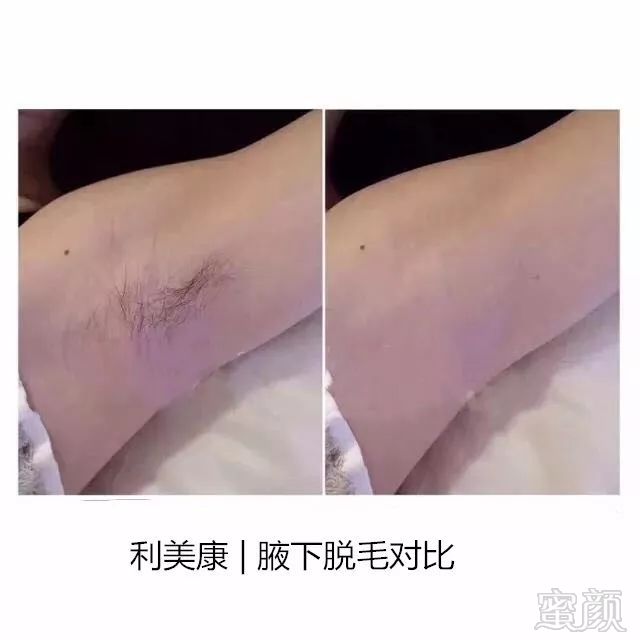 案例图片