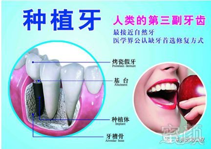 https://img.miyanlife.com/mnt/timg/180722/13442G292-2.jpg