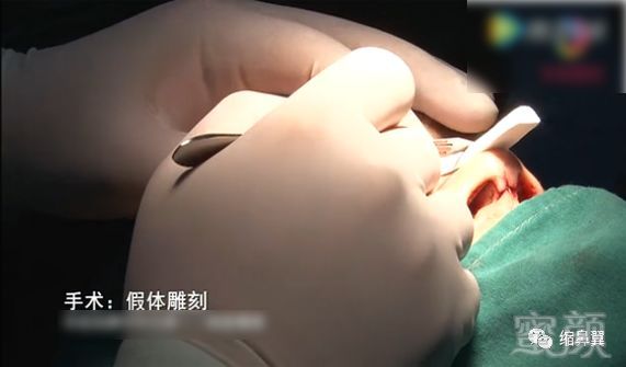 https://img.miyanlife.com/mnt/timg/180722/135HA153-4.jpg