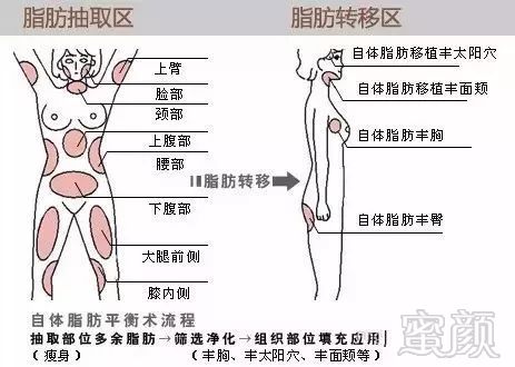 https://img.miyanlife.com/mnt/timg/180723/10531041O-4.jpg