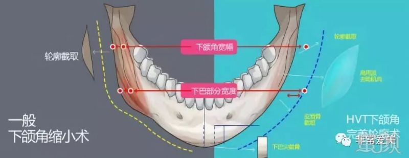 案例图片