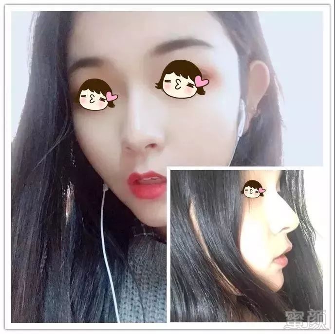 https://img.miyanlife.com/mnt/timg/180723/11234514J-2.jpg