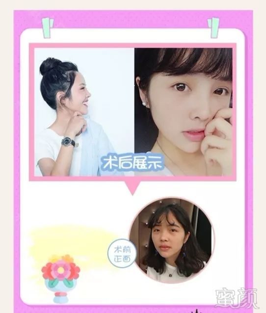 https://img.miyanlife.com/mnt/timg/180723/11234555J-6.jpg