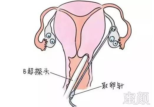 https://img.miyanlife.com/mnt/timg/180723/11293I1S-3.jpg