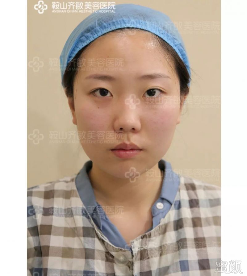 https://img.miyanlife.com/mnt/timg/180723/112P91G4-2.jpg