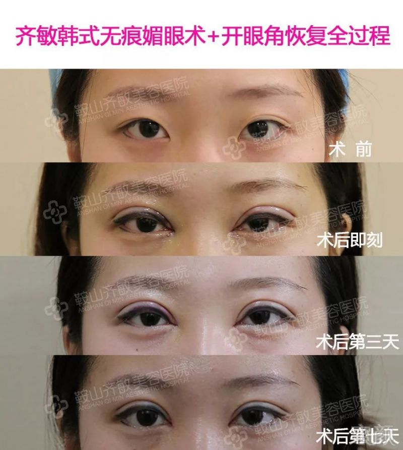 https://img.miyanlife.com/mnt/timg/180723/112Q1H52-8.jpg