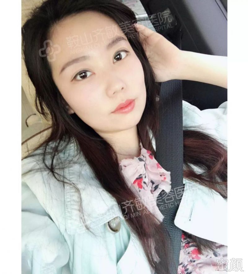 https://img.miyanlife.com/mnt/timg/180723/112Q25093-9.jpg
