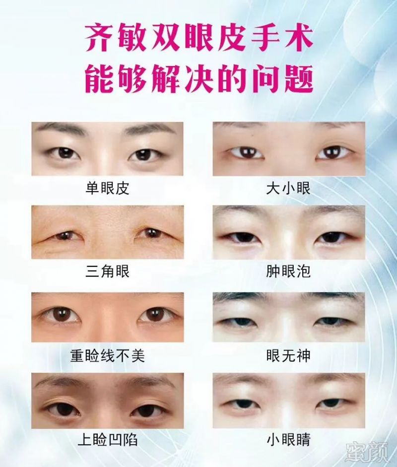https://img.miyanlife.com/mnt/timg/180723/112Q34K0-11.jpg