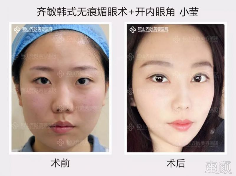 https://img.miyanlife.com/mnt/timg/180723/112Q3FM-10.jpg