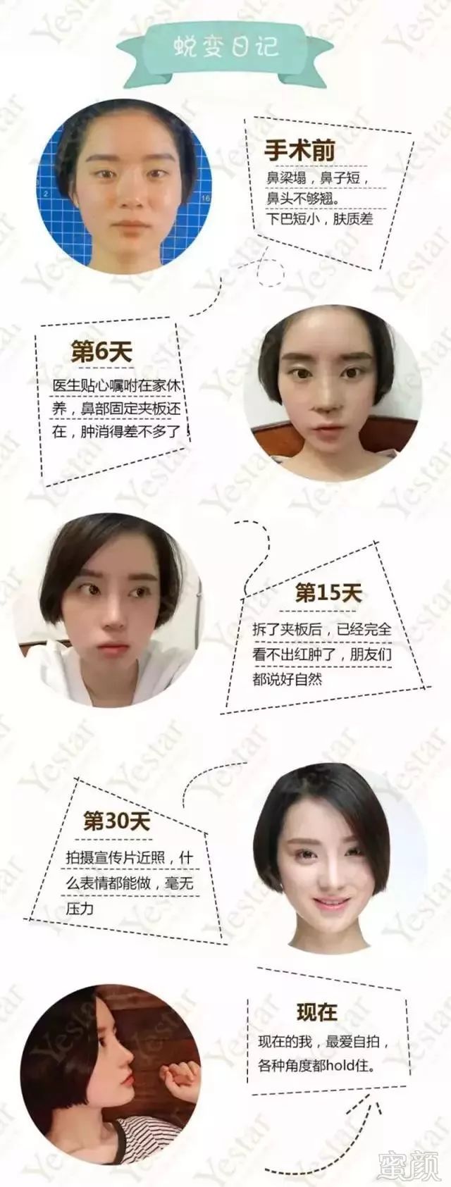 https://img.miyanlife.com/mnt/timg/180723/115U3DN-7.jpg