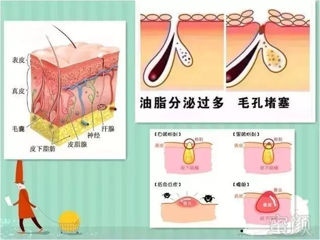 https://img.miyanlife.com/mnt/timg/180723/1200222022-5.jpg