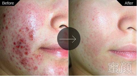 https://img.miyanlife.com/mnt/timg/180723/1200234M1-7.jpg