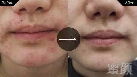 https://img.miyanlife.com/mnt/timg/180723/1200254V2-11.jpg