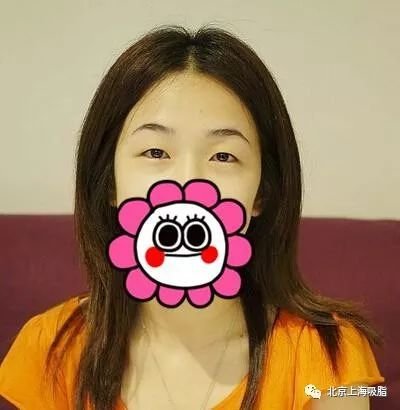 https://img.miyanlife.com/mnt/timg/180724/11334464X-0.jpg