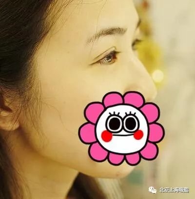 https://img.miyanlife.com/mnt/timg/180724/11334T1W-4.jpg