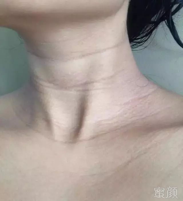 https://img.miyanlife.com/mnt/timg/180724/12015341M-0.jpg