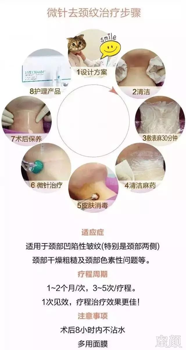 https://img.miyanlife.com/mnt/timg/180724/12015462C-2.jpg