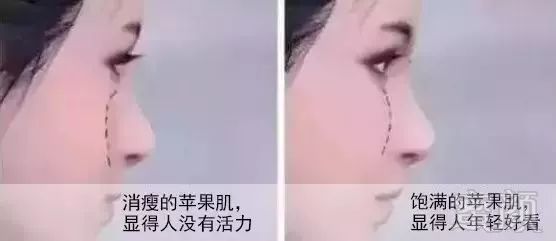 https://img.miyanlife.com/mnt/timg/180724/1202491408-10.jpg