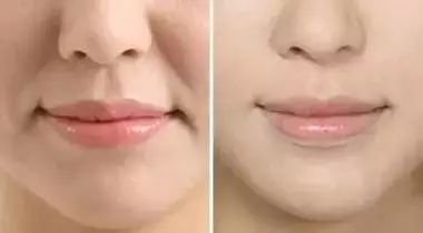 https://img.miyanlife.com/mnt/timg/180724/12024RC4-4.jpg