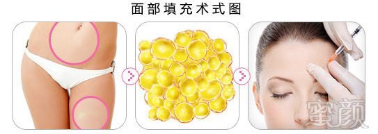 https://img.miyanlife.com/mnt/timg/180724/12045045A-2.jpg