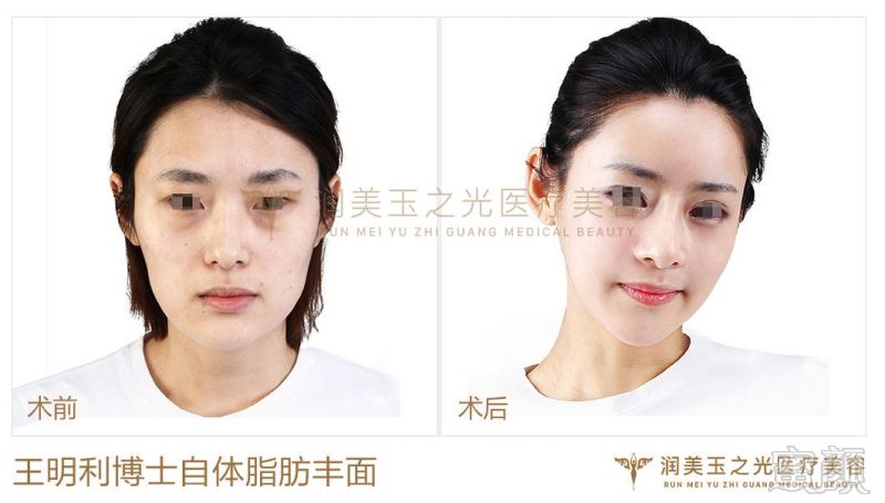 https://img.miyanlife.com/mnt/timg/180724/1204521155-5.jpg