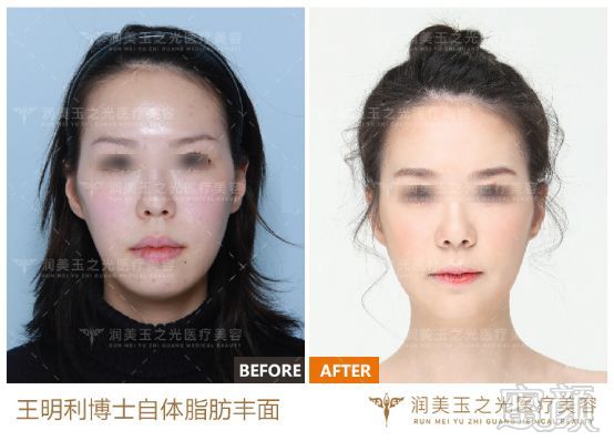 https://img.miyanlife.com/mnt/timg/180724/1204526040-3.jpg