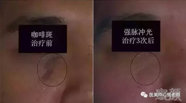 https://img.miyanlife.com/mnt/timg/180724/120Q25928-10.jpg