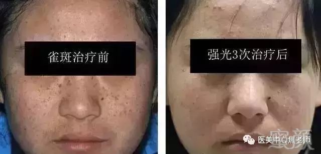 https://img.miyanlife.com/mnt/timg/180724/120Q25b5-8.jpg