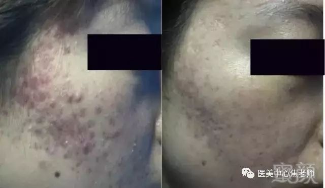 https://img.miyanlife.com/mnt/timg/180724/120Q33C4-11.jpg
