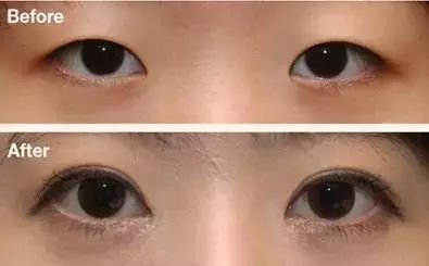 https://img.miyanlife.com/mnt/timg/180724/12113L500-6.jpg