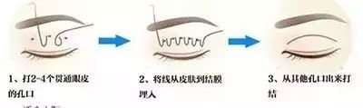 https://img.miyanlife.com/mnt/timg/180724/12113U2B-8.jpg