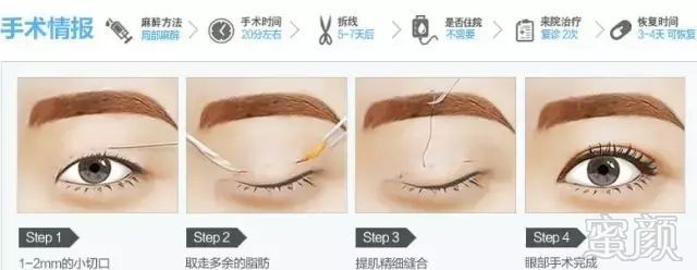 https://img.miyanlife.com/mnt/timg/180724/12113V1C-9.jpg