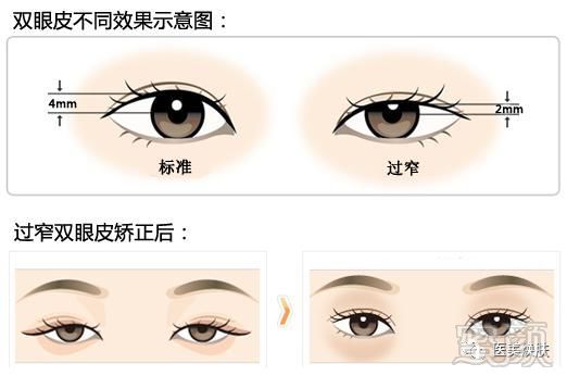 https://img.miyanlife.com/mnt/timg/180724/12133G941-1.jpg
