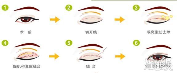 https://img.miyanlife.com/mnt/timg/180724/12133KH5-0.jpg