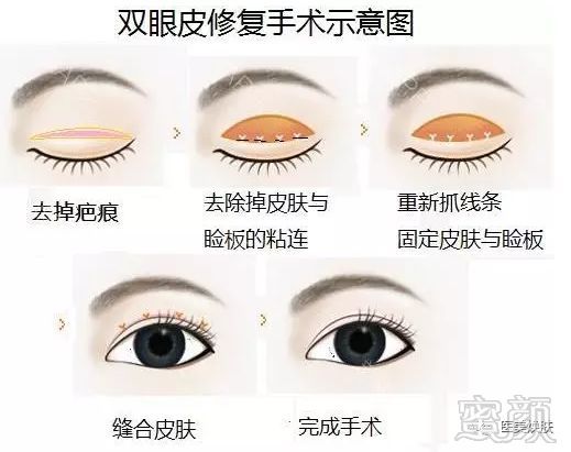 https://img.miyanlife.com/mnt/timg/180724/12133M547-2.jpg