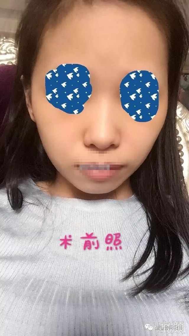https://img.miyanlife.com/mnt/timg/180724/12141462E-0.jpg