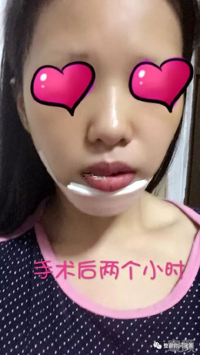 https://img.miyanlife.com/mnt/timg/180724/12141545W-2.jpg