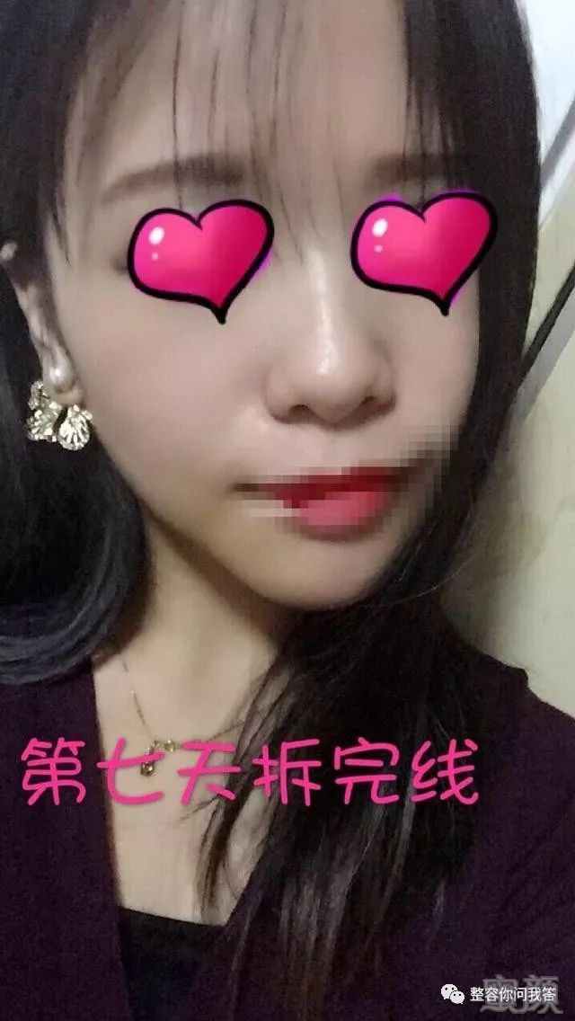 https://img.miyanlife.com/mnt/timg/180724/1214162962-5.jpg